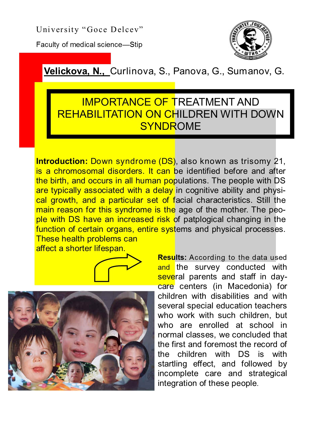 Importance of treatment and rehabilitation on children with Down ...